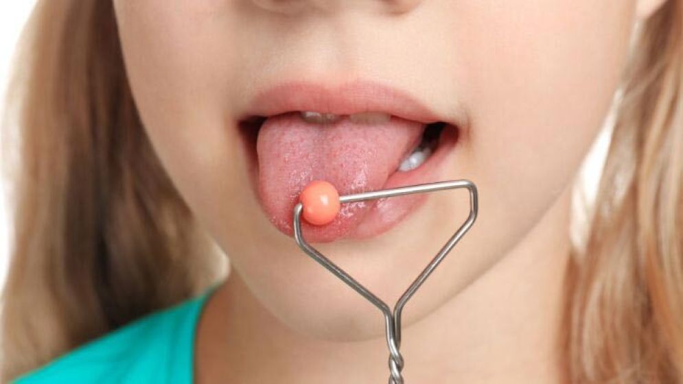 তোতলামি কোনো রোগ নয়, সহজেই ভালো হয়