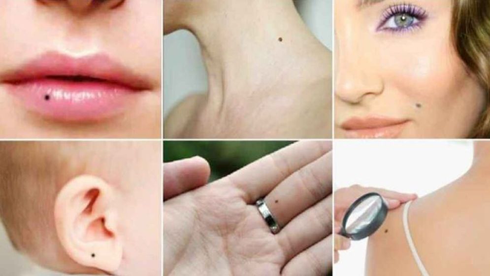 শরীরের কোথায় তিল থাকলে কি হয়