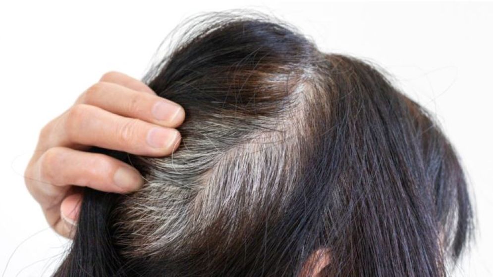 পাকা চুল কি সত্যিই ক্যানসার থেকে বাঁচায়? যা বলছে গবেষণা