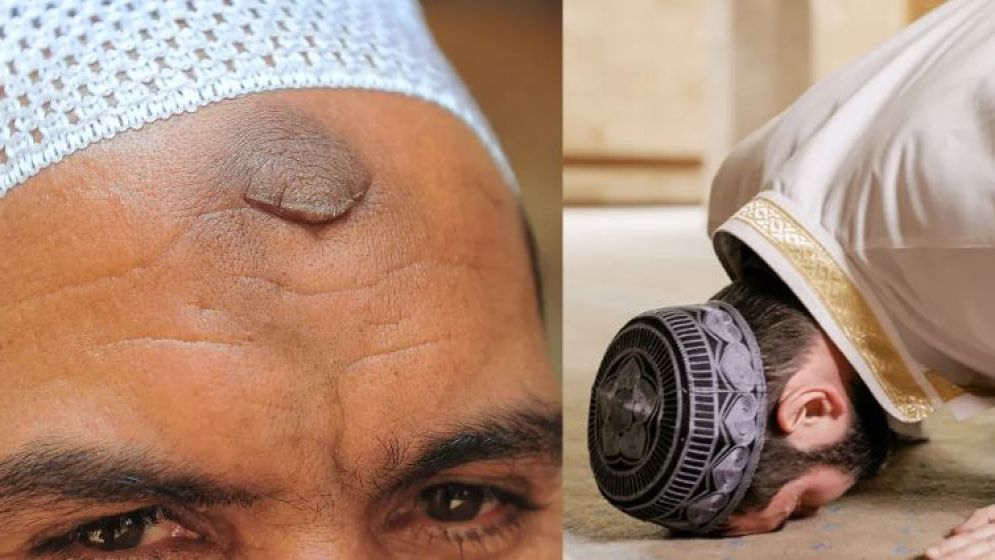 নামাজ পড়তে পড়তে কপালে দাগ ওঠা কি নেককার হওয়ার লক্ষণ?