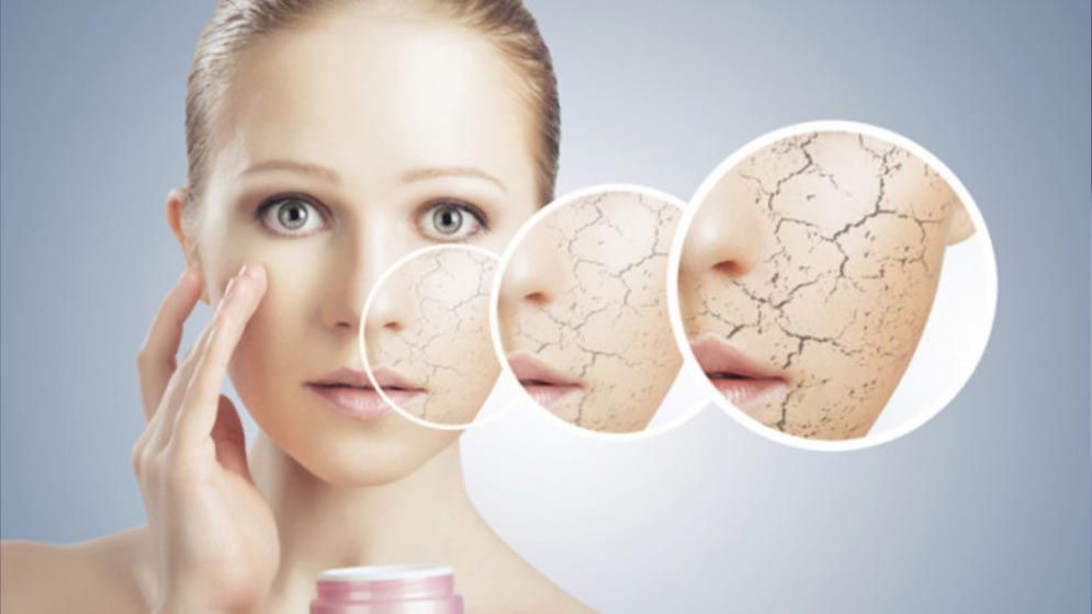 শীতে  ত্বকের শুষ্কতা দূর করার কিছু উপায়