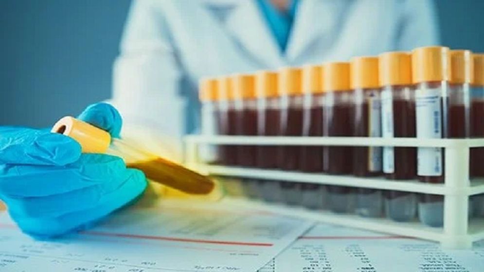 ৬০ লাখে একজন মানুষের শরীরেই মিলছে সোনার চেয়েও দামী রক্ত!