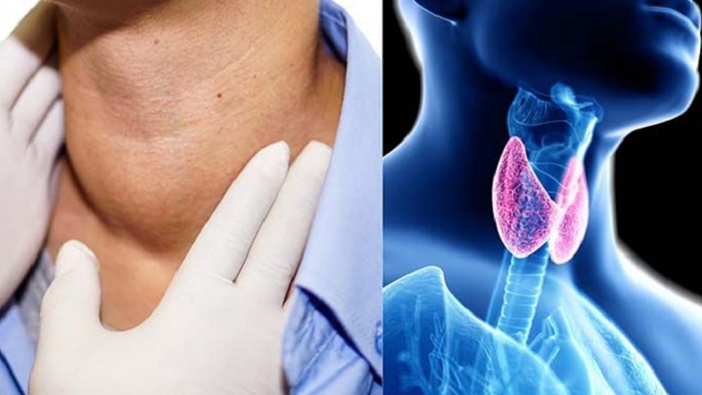 থাইরয়েডের যেসব লক্ষণ অবহেলা করবেন না