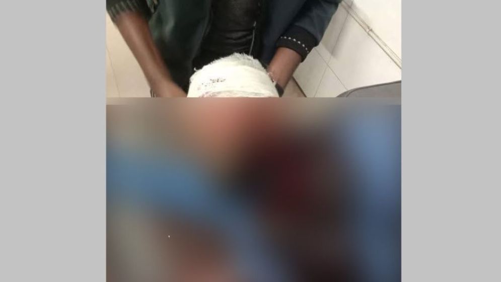 এনসিপির খুলনা বিভাগীয় প্রধানের মাথায় গুলি