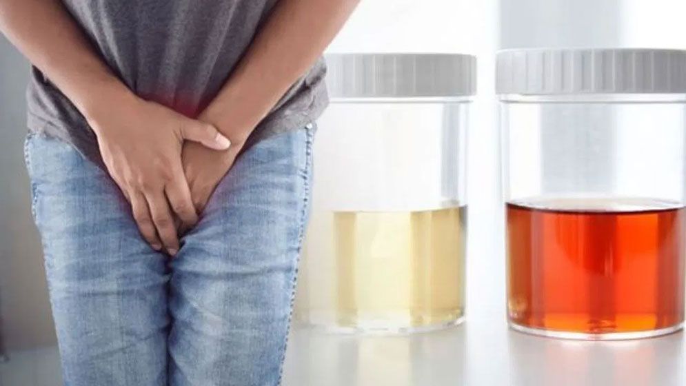 দিনে চারবারের কম ও আটবারের বেশি প্রস্রাবে কী হতে পারে?
