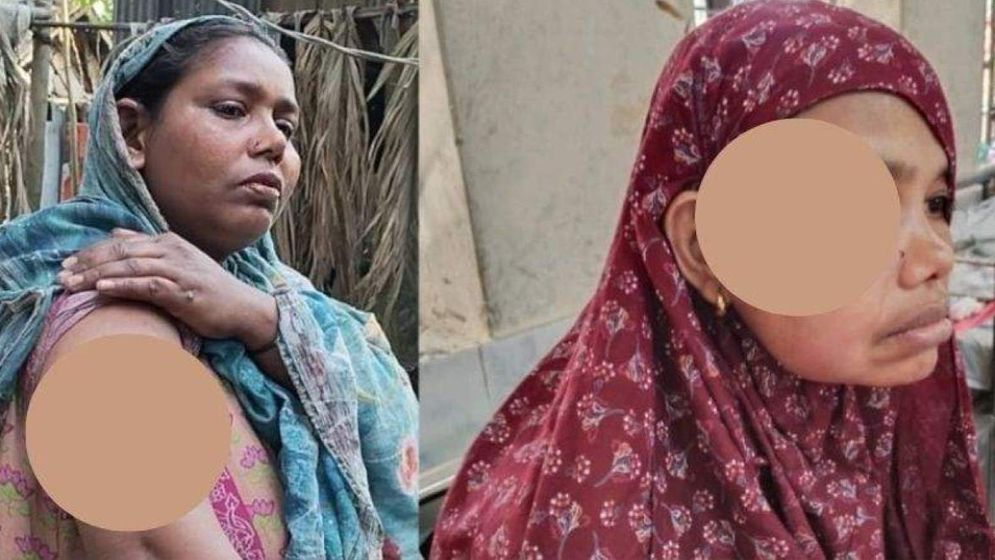 দাঁড়িপাল্লায় ভোট: বিএনপি নেতার নেতৃত্বে তিন নারীকে পিটিয়ে জখম