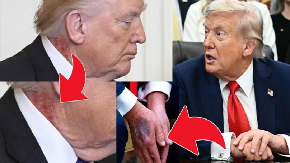 ভয়ংকর রোগে আক্রান্ত ট্রাম্প, ভেতর থেকে পঁচে যাচ্ছে শরীর!