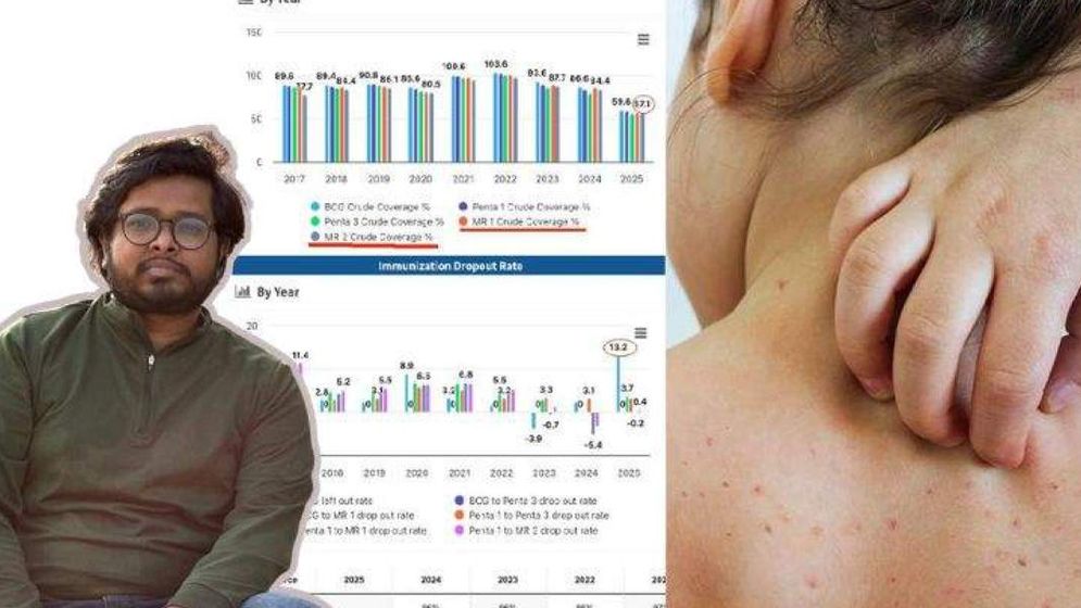 হাম নিয়ে দোষ চাপানোয় ব্যস্ত রাজনীতিবিদরা