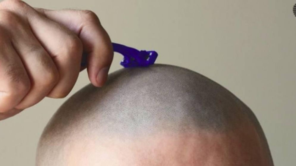 বারবার নেড়া করলেও শিশুর মাথাভর্তি চুল হয় না কেন, জেনে নিন