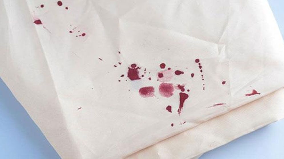 মাছের রক্তে কি কাপড় অপবিত্র হয়?