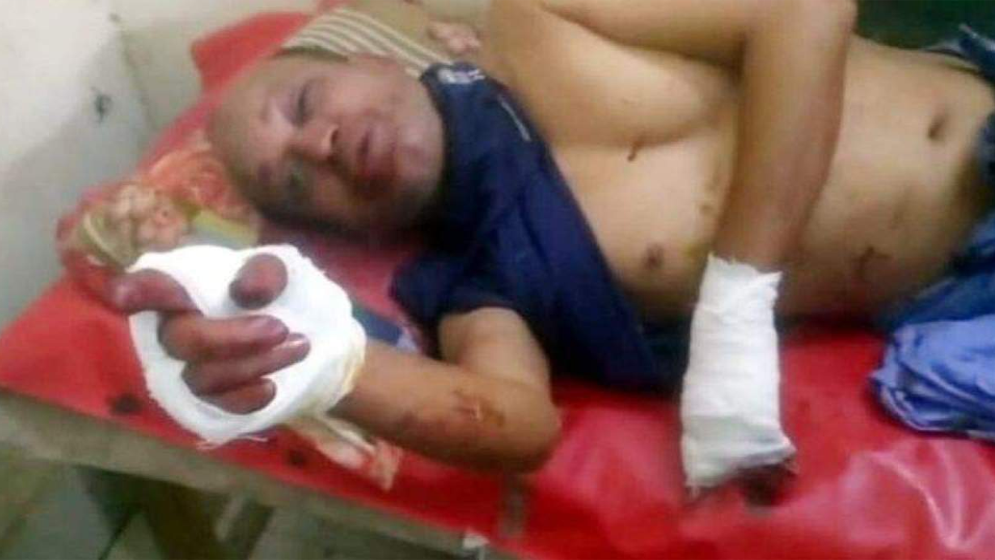 মেয়ে হাত-পা চেপে ধরেন, বুকের ওপর বসে স্ত্রী, ছুরি চালান ছেলে