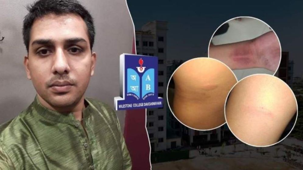 হোমওয়ার্ক না করার অজুহাতে ক্লাসরুমে মাইলস্টোন ছাত্রকে পিটিয়ে জখম