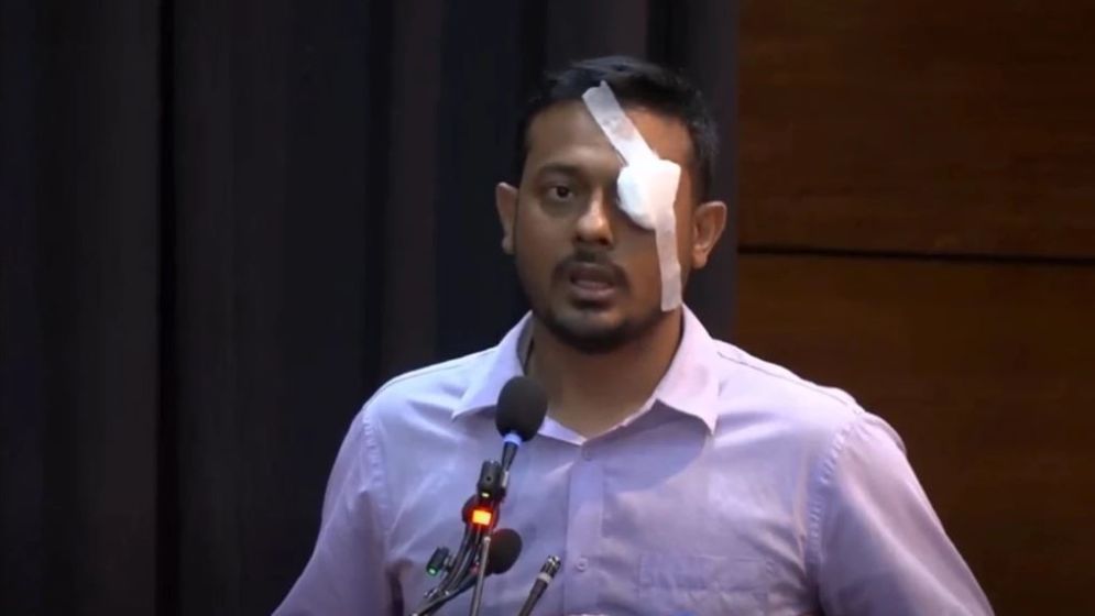 নাসীরুদ্দীন পাটওয়ারীর চোখে ব্যান্ডেজ, জানালেন কারণ