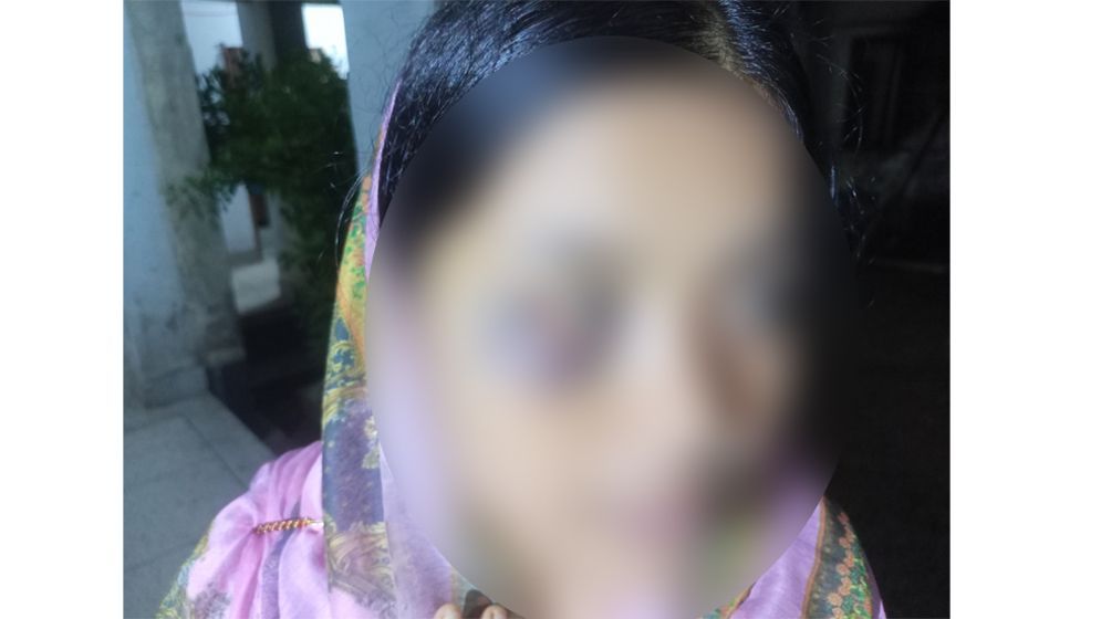 ‘যৌতুকের জন্য ঘুসি মেরেছি, খুন তো করিনি’