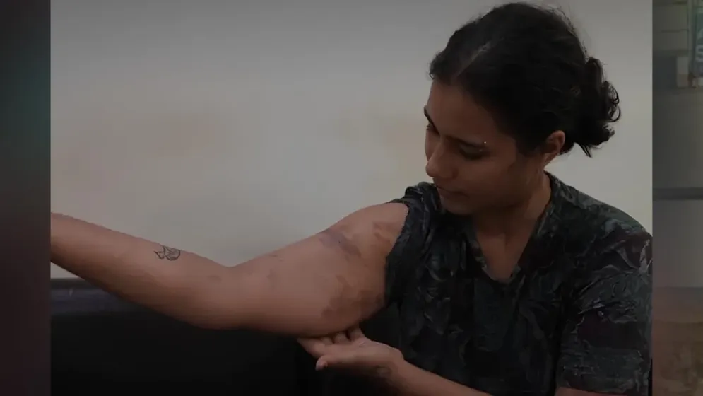 ‘যৌনাঙ্গে বুট দিয়ে মেরেছে’, দিল্লিতে আটক বিক্ষোভকারী