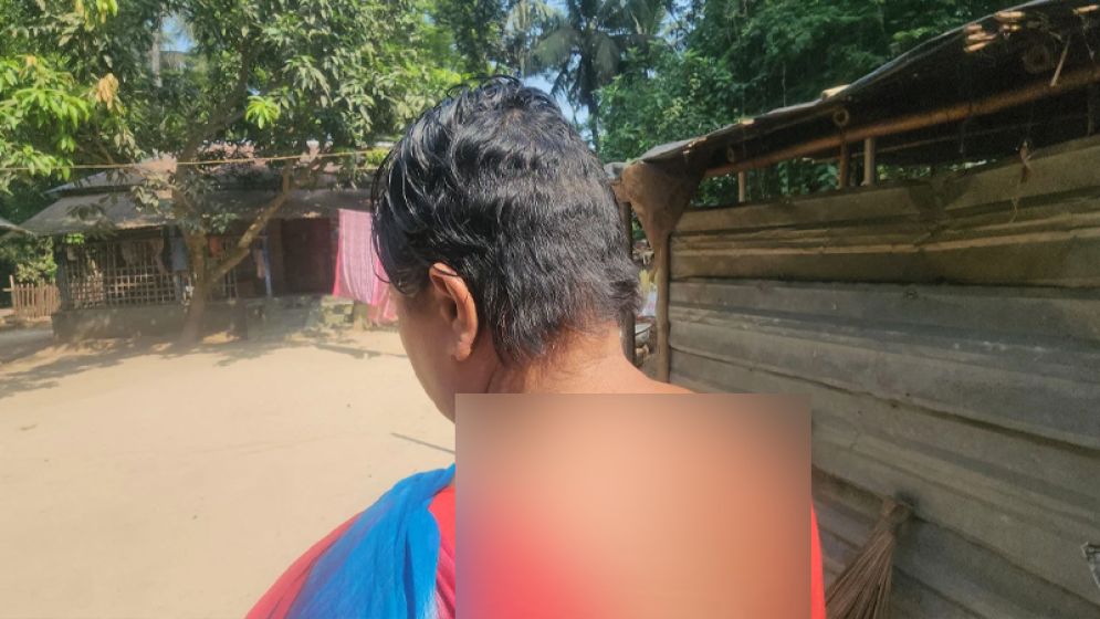 পরকীয়া সন্দেহে নারীর চুল কেটে শরীরে মরিচের গুঁড়া দেওয়ার অভিযোগ